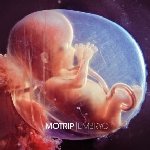 Embryo - MoTrip